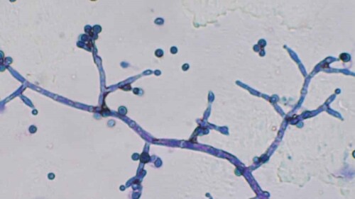 Efectos positivos de la aplicación de Trichoderma a semillas de pepino